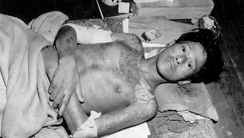 80 Yıl Sonra Nagasaki’den Şok Eden Çağrı: Nükleer Felaket İhtimali Yükseliyor