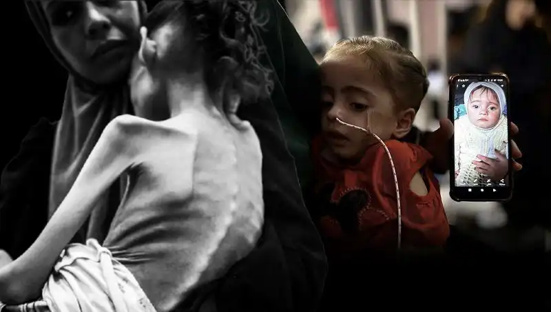 25 Kilodan 10 Kiloya Düşen Meryem’in Açlıkla Dolu Hikayesi