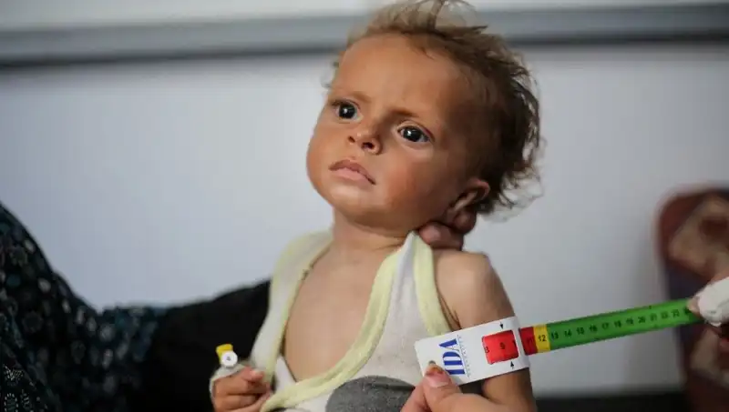 İngiltere, 300 Gazzeli Çocuğa Yeni Bir Yaşam Sunacak
