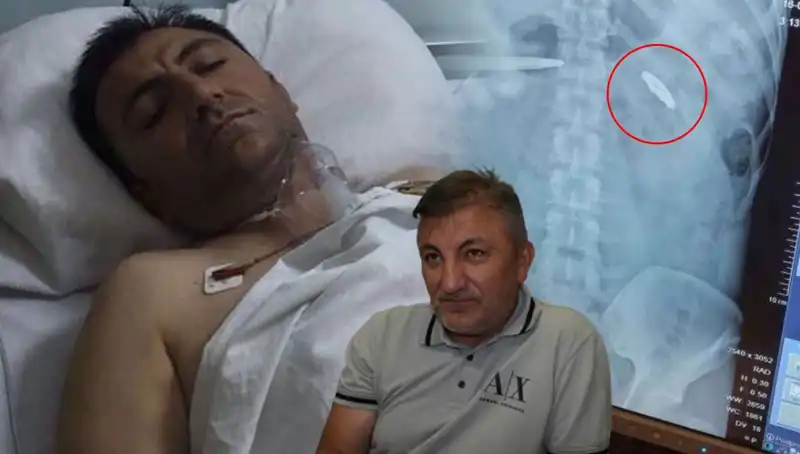 15 Temmuz'un Acı Mirası: Vücudunda Kurşunla 9 Yıl Geçiren Kahramanın Hikayesi
